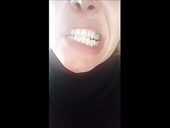 beautiful face, but rotten teeth!
